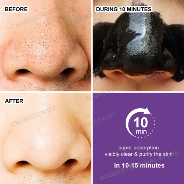 Blackhead Remover Face Mask Cream Oil-Control Nose Black Dots Mask Deep Cleansing Pore Nose Men Women Beauty Cosmetics Skin Care - Image 2