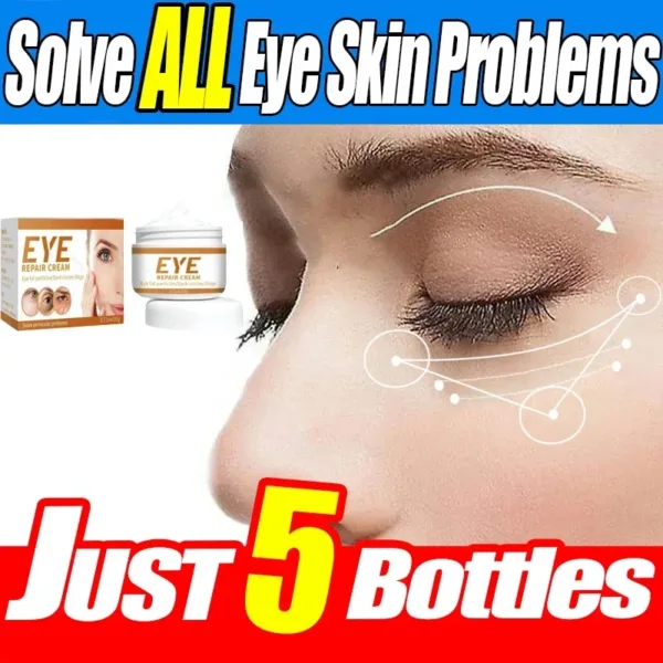Smoothes Winkles Rolling Eye Cream Eye Bags Dark Circles Anti Puffiness Firm Cream Under Eyes Moisturizing Whitening Skin Care - Image 2