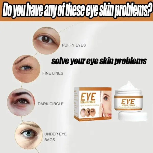 Smoothes Winkles Rolling Eye Cream Eye Bags Dark Circles Anti Puffiness Firm Cream Under Eyes Moisturizing Whitening Skin Care - Image 5