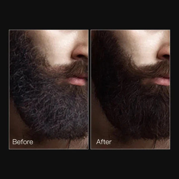 50ml Facial Hair Growth Beard Growth Essential Oil Improves Frizz Fast Powerful Hair Growth Liquid Man Beard Modifier Product - Image 5
