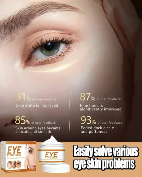 Smoothes Winkles Rolling Eye Cream Eye Bags Dark Circles Anti Puffiness Firm Cream Under Eyes Moisturizing Whitening Skin Care - Image 11