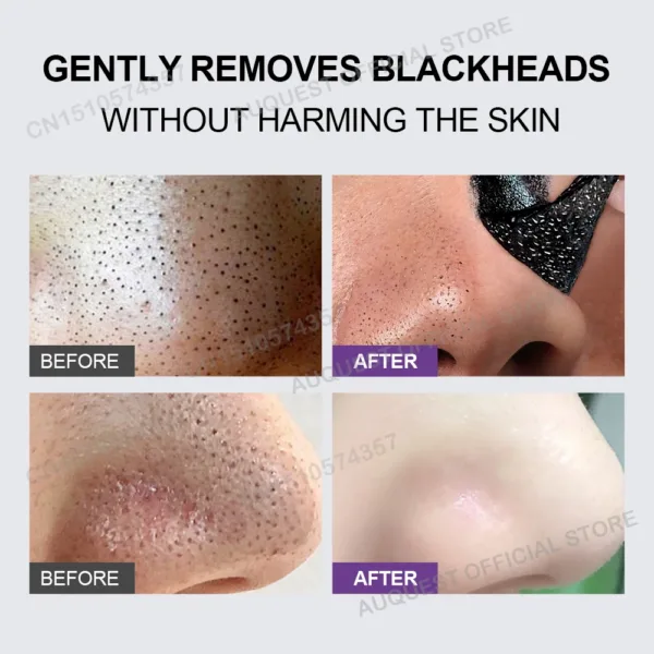 Blackhead Remover Face Mask Cream Oil-Control Nose Black Dots Mask Deep Cleansing Pore Nose Men Women Beauty Cosmetics Skin Care - Image 3