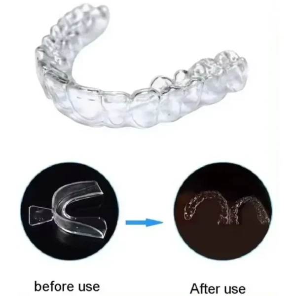 2/4pcs Silicone Mouth Guard Teeth Protector Night Guard Mouth Tray for Bruxism Grinding Non-snoring Teeth Whitening Protection - Image 2