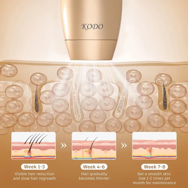 KODO 2024 High-end customization ice Laser Hair removal Laser Epilator Permanent IPL Painless Photoepilator 4 in 1 face and body - Image 6